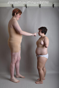 two models one very tall the other very short and the tall model is booping the short model's nose. The short model has one arm amputated at the elbow
